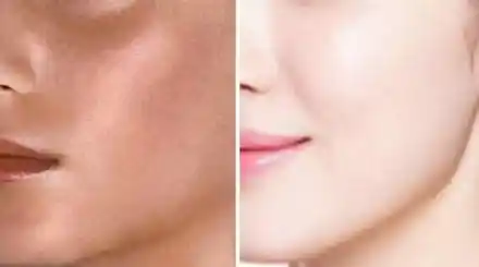Homepage - Skin Whitening Courses Review