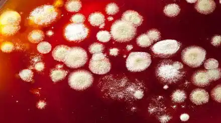 Homepage - Candida Disease Courses Review